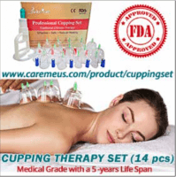 cupping-therapy-set-ad
