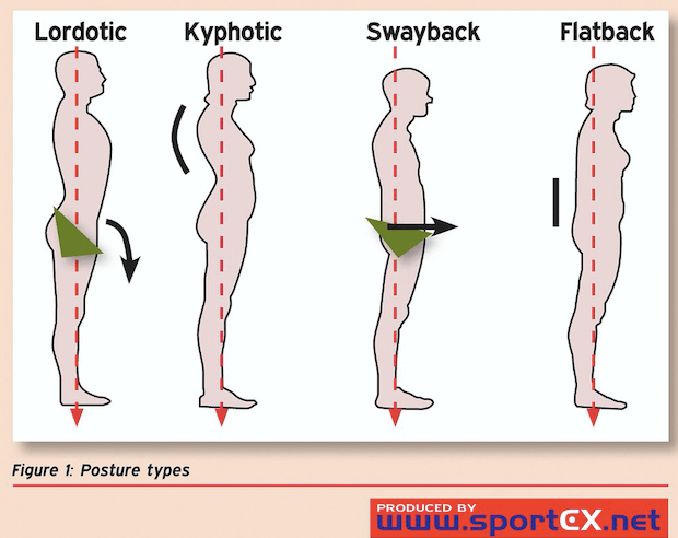 posture-types2