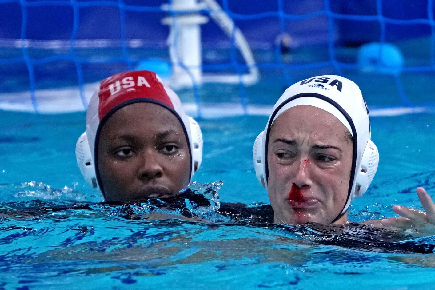 Jul 26, 2021; Tokyo, Japan; United States driver Margaret Steffens (6) bleeds from her nose against China in womens group B water polo during the Tokyo 2020 Olympic Summer Games at Tatsumi Water Polo Centre. Mandatory Credit: Kirby Lee-USA TODAY Sports